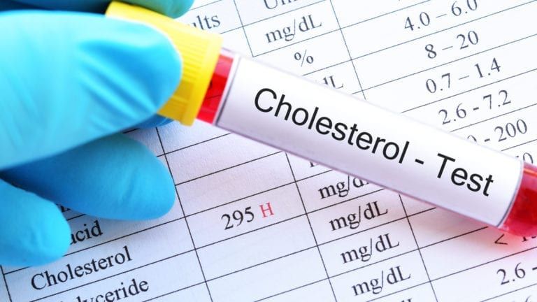 Vial of Cholesterol Test in front of cholesterol results