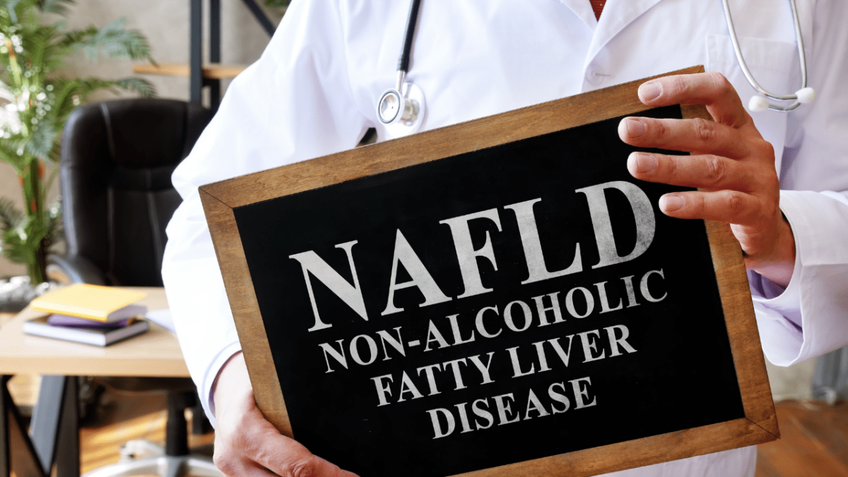 What You Need to Know About Non-Alcoholic Fatty Liver Disease